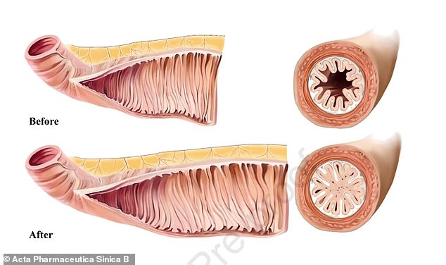 Chinese researchers warn that people who take GLP-1 drugs such as Wegovy will experience an enlarged intestine, which is less flexible and more prone to blockages