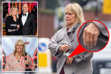 Linda Robson ditches wedding ring after 'ups & downs' with husband