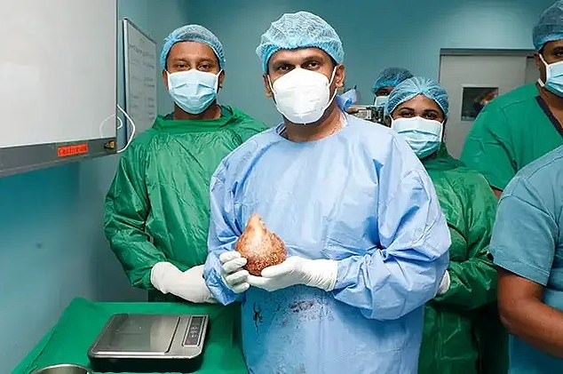 Canistus Coonghe has broke two world records after army surgeon Dr Kugadas Sutharshan, pictured middle, removed a 13.37 cm long and 10.55 cm wide kidney stone