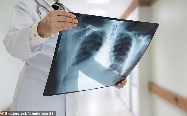 Now the NHS radiographers will strike with staff who operate essential diagnostic equipment like X-Rays and CT scans likely to walk off the job next month over pay