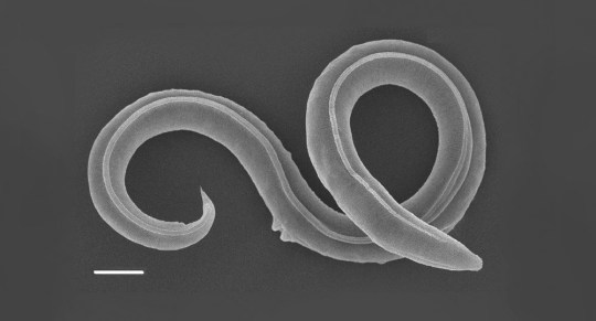 46,000-Year-Old Worm Possibly Revived from Siberian Permafrost