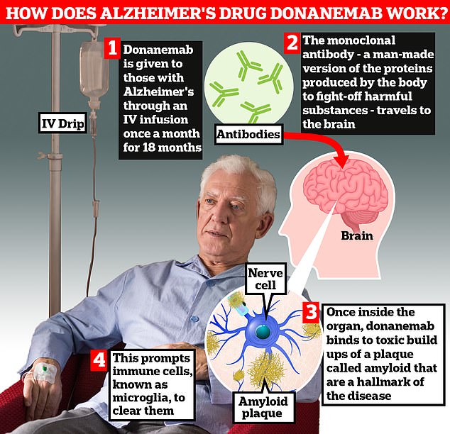 Donanemab is given to Alzheimer's patients through an IV infusion once a month. The monoclonal antibody — a man-made version of proteins produced by the body to fight-off harmful substances — travels to the brain . Once inside the organ, donanemab binds to toxic build-ups of amyloid plaque — a hallmark sign of the memory-robbing disease. This prompts immune cells, known as microglia, to clear them