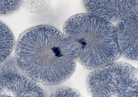 PCNA is essential for cell division – but in a mutated form helps cancer tumours grow