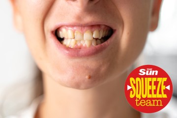 I paid £637 to get veneers but I'm not happy - can you help me get my money back?