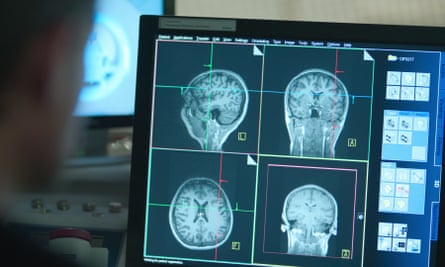 A person looking at a screen showing brain scans