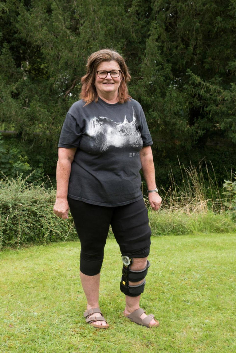 Debs Orchard, who lives in Bodenham, snapped the ligament in her knee while on holiday