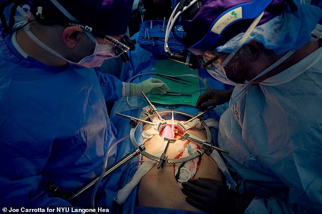 Jeffrey Stern (left) and Robert Montgomery (right) examine the pig kidney moments after blood flow is restored to the organ on July 14