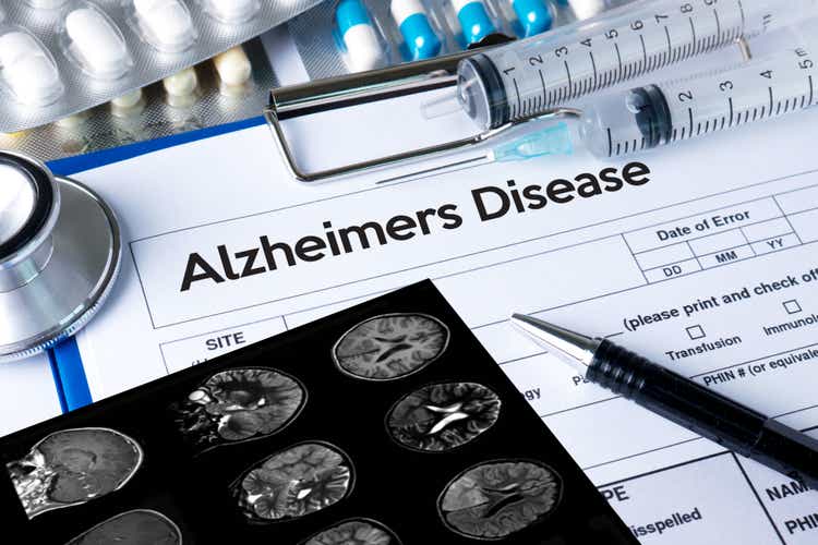 Alzheimers Disease concept , Brain degenerative diseases Parkinson