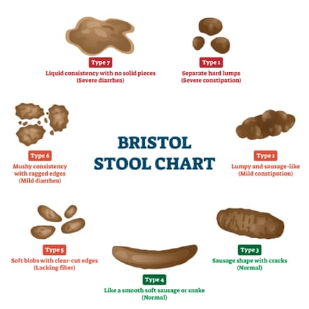 The Bristol stool chart