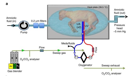 Diagram of the artificial womb