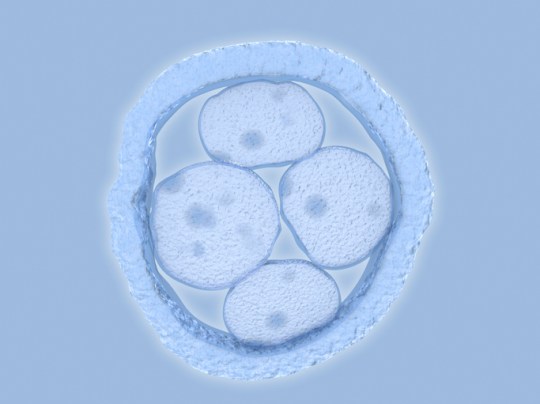 Human embryo