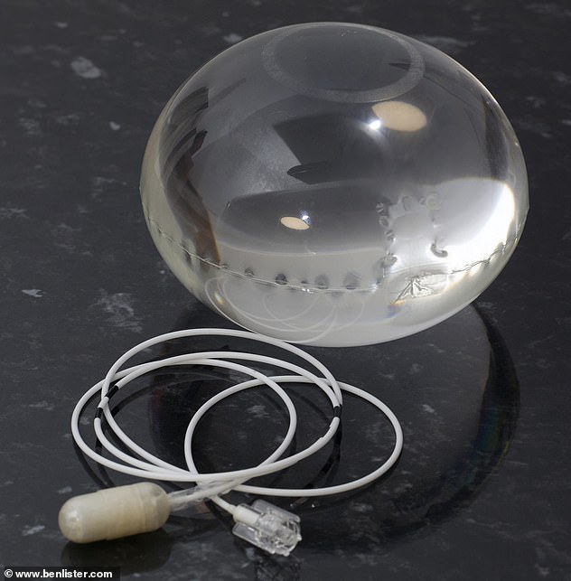 Inside the 3cm-long and 2cm-wide capsule sits a collapsed balloon. Attached to that is a thin tube, which doctors feed 550ml saline through to fill the balloon. An X-ray is done to confirm it is correctly sat in the stomach. When the balloon is full, the connection valve automatically seals itself. A second x-ray confirms it is still sat correctly before the tube is then removed