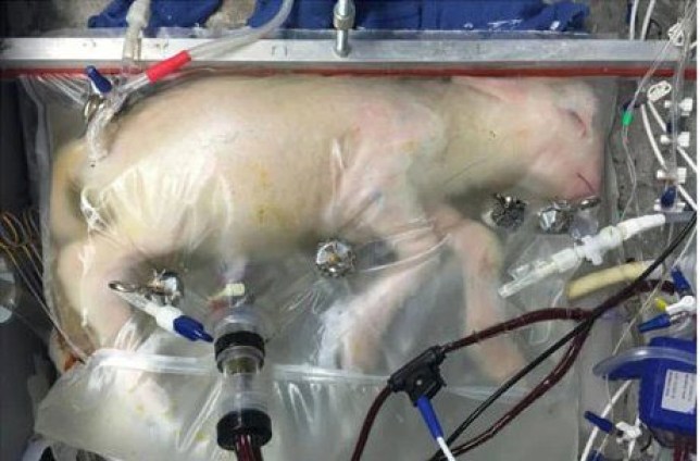 Artificial womb