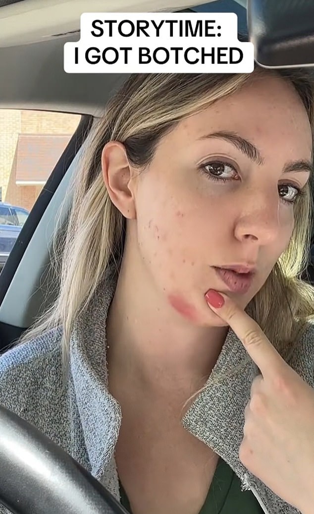 TikToker Kaleysfavs said her dermal filler became infected because she was experiencing an acne breakout when she underwent the cosmetic procedure