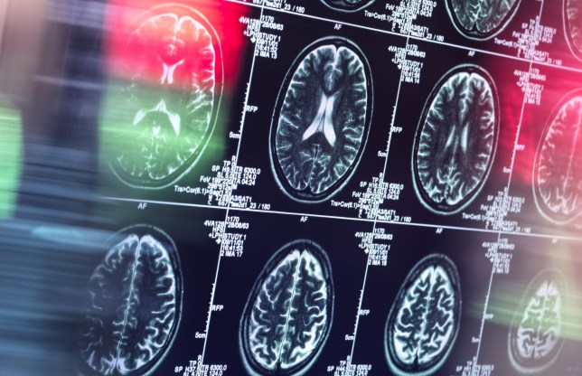 Human brain scan in neurology clinic