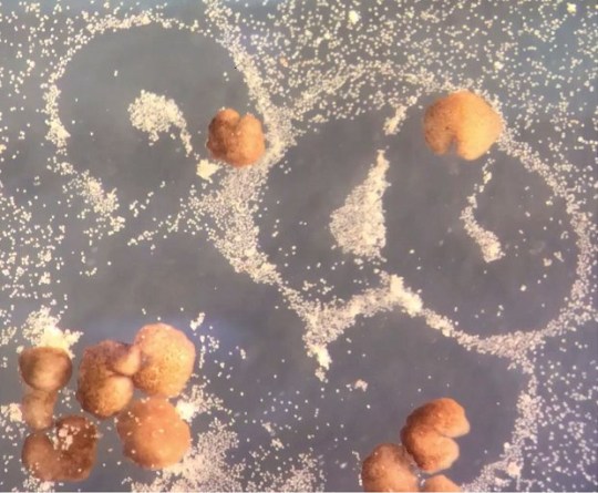 Light brown peanut-shaped organisms gathering up hundreds of individual cells.