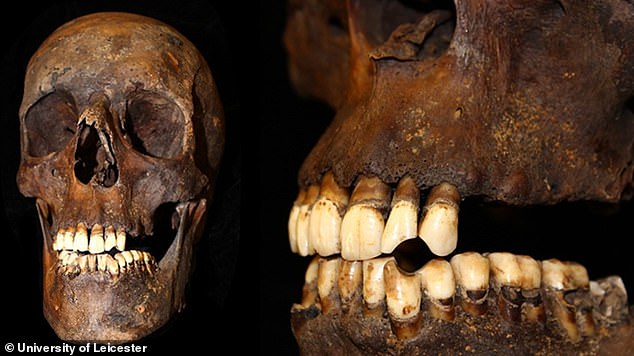 Scientists can tell if a deceased individual smoked because of stains or marks on the teeth. For example, dents known as 'pipe notches' would have been formed by a tobacco pipe, while 'lingual staining' is black or brown marks on the part of the tooth surface facing the tongue